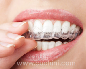Get Whiter Teeth Whitening Strips Whitening Tray