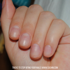 Tricks to Stop Biting Your Nails