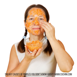 Sneaky Causes of Pimples You Don't Know About