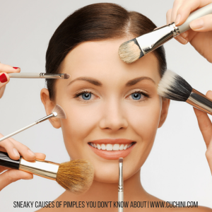 Sneaky Causes of Pimples You Don't Know About