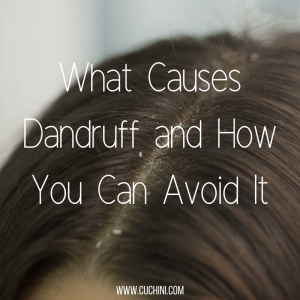 What Causes Dandruff and How Can You Avoid It_