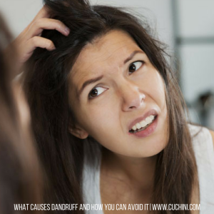 What Causes Dandruff and How You can Avoid It