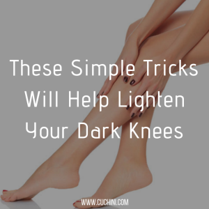 These Simple Tricks Will Help Lighten Your Dark Knees