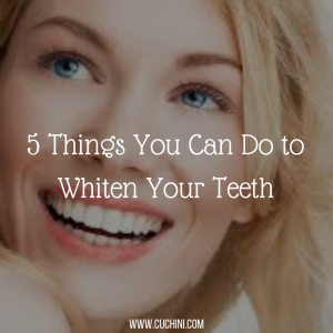 5 Things You Can Do to Whiten Your Teeth